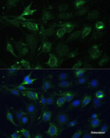 Immunofluorescence analysis of C6 cells using COX6A1 Polyclonal Antibody at dilution of 1:100 (40x lens) . Blue: DAPI for nuclear staining.