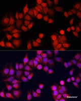 Immunofluorescence analysis of HeLa cells using CSTB Polyclonal Antibody at dilution of 1:100. Blue: DAPI for nuclear staining.