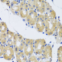 Immunohistochemistry of paraffin-embedded Human stomach using DYNC1I1 Polyclonal Antibody at dilution of 1:100 (40x lens) .