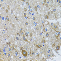 Immunohistochemistry of paraffin-embedded Rat brain using DYNC1I1 Polyclonal Antibody at dilution of 1:100 (40x lens) .