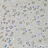 Immunohistochemistry of paraffin-embedded Rat brain using EIF4A2 Polyclonal Antibody at dilution of 1:100 (40x lens) .