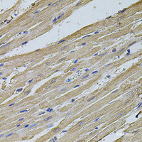 Immunohistochemistry of paraffin-embedded Rat heart using EIF4A2 Polyclonal Antibody at dilution of 1:100 (40x lens) .