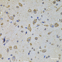 Immunohistochemistry of paraffin-embedded Mouse brain using EIF4A2 Polyclonal Antibody at dilution of 1:100 (40x lens) .