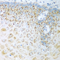 Immunohistochemistry of paraffin-embedded Human esophagus using FDXR Polyclonal Antibody at dilution of 1:100 (40x lens) .