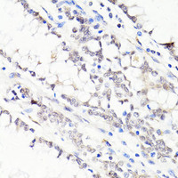 Immunohistochemistry of paraffin-embedded Human colon using FKBP5 Polyclonal Antibody at dilution of 1:100 (40x lens) .