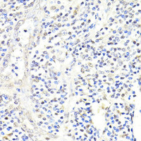 Immunohistochemistry of paraffin-embedded Human appendix using FKBP5 Polyclonal Antibody at dilution of 1:100 (40x lens) .