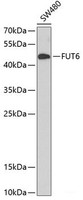 Western blot analysis of extracts of SW480 cells using FUT6 Polyclonal Antibody at dilution of 1:1000.