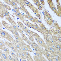 Immunohistochemistry of paraffin-embedded Human liver using FUT6 Polyclonal Antibody at dilution of 1:100 (40x lens) .