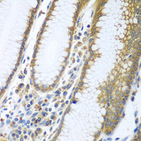 Immunohistochemistry of paraffin-embedded Human stomach using FUT6 Polyclonal Antibody at dilution of 1:100 (40x lens) .