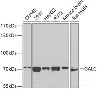 Western blot analysis of extracts of various cell lines using GALC Polyclonal Antibody at dilution of 1:1000.