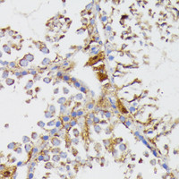 Immunohistochemistry of paraffin-embedded Mouse testis using GALC Polyclonal Antibody at dilution of 1:100 (40x lens) .