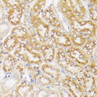 Immunohistochemistry of paraffin-embedded Mouse kidney using GALC Polyclonal Antibody at dilution of 1:100 (40x lens) .