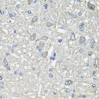 Immunohistochemistry of paraffin-embedded Rat brain using GFPT1 Polyclonal Antibody at dilution of 1:100 (40x lens) .