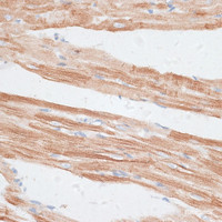 Immunohistochemistry of paraffin-embedded Rat heart using GRK5 Polyclonal Antibody at dilution of 1:100 (40x lens) .