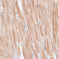 Immunohistochemistry of paraffin-embedded Mouse heart using GRK5 Polyclonal Antibody at dilution of 1:100 (40x lens) .