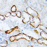 Immunohistochemistry of paraffin-embedded Mouse kidney using IL3RA Polyclonal Antibody at dilution of 1:100 (40x lens) .