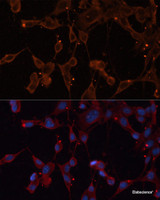 Immunofluorescence analysis of NIH/3T3 cells using INPP5B Polyclonal Antibody at dilution of 1:100. Blue: DAPI for nuclear staining.