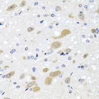 Immunohistochemistry of paraffin-embedded Rat brain using LCAT Polyclonal Antibody at dilution of 1:100 (40x lens) .