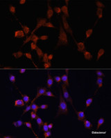 Immunofluorescence analysis of NIH/3T3 cells using MOV10 Polyclonal Antibody at dilution of 1:100. Blue: DAPI for nuclear staining.