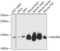 Western blot analysis of extracts of various cell lines using NDUFB2 Polyclonal Antibody at dilution of 1:3000.
