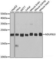 Western blot analysis of extracts of various cell lines using NDUFB10 Polyclonal Antibody at dilution of 1:1000.