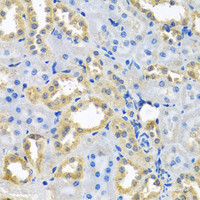 Immunohistochemistry of paraffin-embedded Rat kidney using NDUFB10 Polyclonal Antibody at dilution of 1:100 (40x lens) .