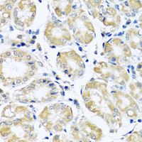 Immunohistochemistry of paraffin-embedded Human stomach using NDUFB10 Polyclonal Antibody at dilution of 1:100 (40x lens) .
