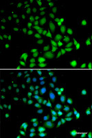Immunofluorescence analysis of U2OS cells using PARN Polyclonal Antibody