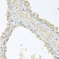 Immunohistochemistry of paraffin-embedded Human prostate using PMM2 Polyclonal Antibody at dilution of 1:100 (40x lens) .