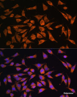 Immunofluorescence analysis of L929 cells using PMM2 Polyclonal Antibody at dilution of 1:100. Blue: DAPI for nuclear staining.