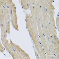 Immunohistochemistry of paraffin-embedded Mouse heart using PRPH Polyclonal Antibody at dilution of 1:100 (40x lens) .