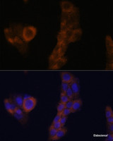 Immunofluorescence analysis of A-431 cells using RPL23A Polyclonal Antibody at dilution of 1:100. Blue: DAPI for nuclear staining.
