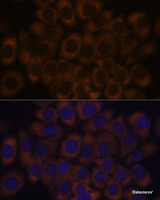 Immunofluorescence analysis of HeLa cells using RPL23A Polyclonal Antibody at dilution of 1:100. Blue: DAPI for nuclear staining.