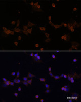 Immunofluorescence analysis of NIH-3T3 cells using UBE2L3 Polyclonal Antibody at dilution of 1:100 (40x lens) . Blue: DAPI for nuclear staining.