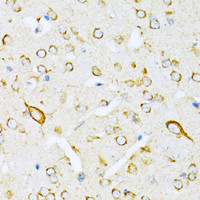 Immunohistochemistry of paraffin-embedded Mouse brain using VARS Polyclonal Antibody at dilution of 1:100 (40x lens) .