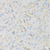 Immunohistochemistry of paraffin-embedded Mouse liver using IFITM1 Polyclonal Antibody at dilution of 1:100 (40x lens) .