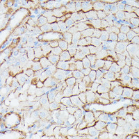 Immunohistochemistry of paraffin-embedded Mouse kidney using IFITM1 Polyclonal Antibody at dilution of 1:100 (40x lens) .