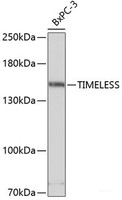 Western blot analysis of extracts of BxPC-3 cells using TIMELESS Polyclonal Antibody at dilution of 1:3000.