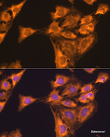 Immunofluorescence analysis of C6 cells using RPL23 Polyclonal Antibody at dilution of 1:100. Blue: DAPI for nuclear staining.