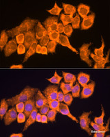 Immunofluorescence analysis of HeLa cells using RPL23 Polyclonal Antibody at dilution of 1:100. Blue: DAPI for nuclear staining.