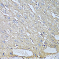 Immunohistochemistry of paraffin-embedded Human liver using RPH3AL Polyclonal Antibody at dilution of 1:100 (40x lens) .