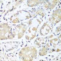 Immunohistochemistry of paraffin-embedded Human stomach using RPH3AL Polyclonal Antibody at dilution of 1:100 (40x lens) .