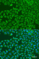 Immunofluorescence analysis of U2OS cells using FXR2 Polyclonal Antibody at dilution of 1:100. Blue: DAPI for nuclear staining.