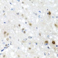 Immunohistochemistry of paraffin-embedded Rat brain using SAFB2 Polyclonal Antibody at dilution of 1:100 (40x lens) .