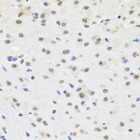 Immunohistochemistry of paraffin-embedded Mouse brain using SAFB2 Polyclonal Antibody at dilution of 1:100 (40x lens) .