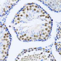 Immunohistochemistry of paraffin-embedded Mouse testis using DDX46 Polyclonal Antibody at dilution of 1:100 (40x lens) .