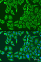 Immunofluorescence analysis of U2OS cells using ABCF2 Polyclonal Antibody at dilution of 1:100. Blue: DAPI for nuclear staining.