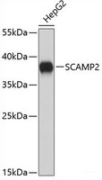 Western blot analysis of extracts of HepG2 cells using SCAMP2 Polyclonal Antibody.