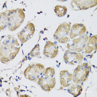 Immunohistochemistry of paraffin-embedded Human stomach using USH1C Polyclonal Antibody at dilution of 1:100 (40x lens) .