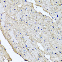 Immunohistochemistry of paraffin-embedded Rat heart using USH1C Polyclonal Antibody at dilution of 1:100 (40x lens) .